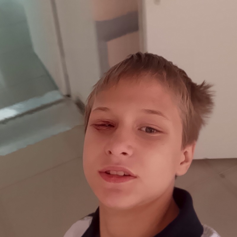 Mateo, 18